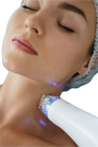 Microneedling
